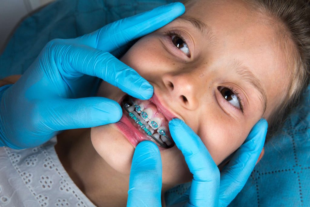 Early Orthodontic